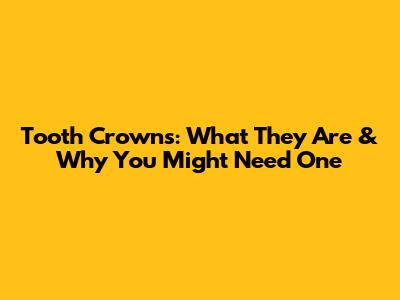 Tooth Crowns: What They Are & Why You Might Need One